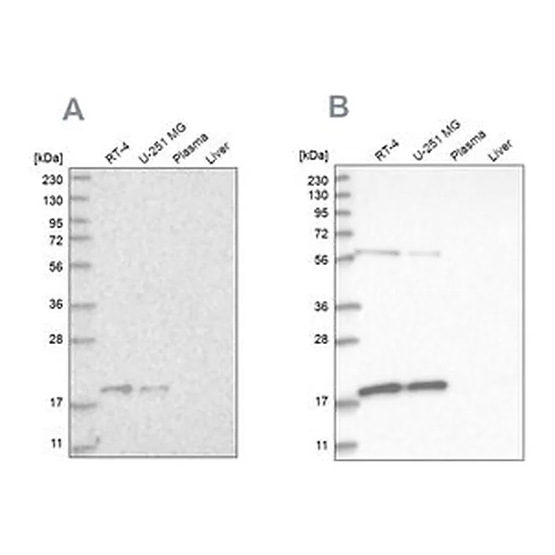 Merck Anti-MRPS10 antibody produced in rabbit