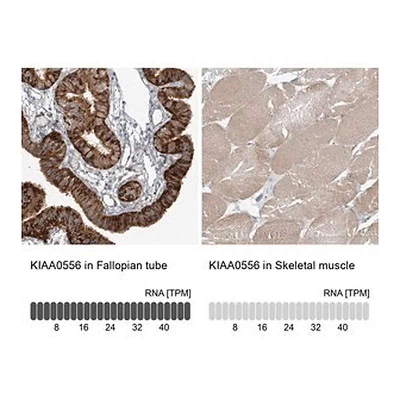 Merck Anti-KIAA0556 antibody produced in rabbit