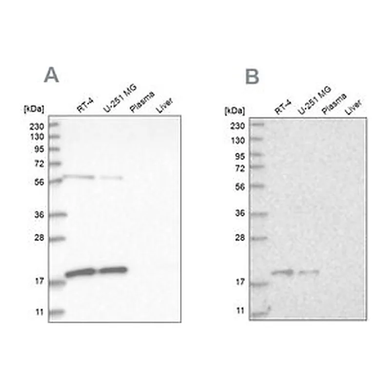 Merck Anti-MRPS10 antibody produced in rabbit