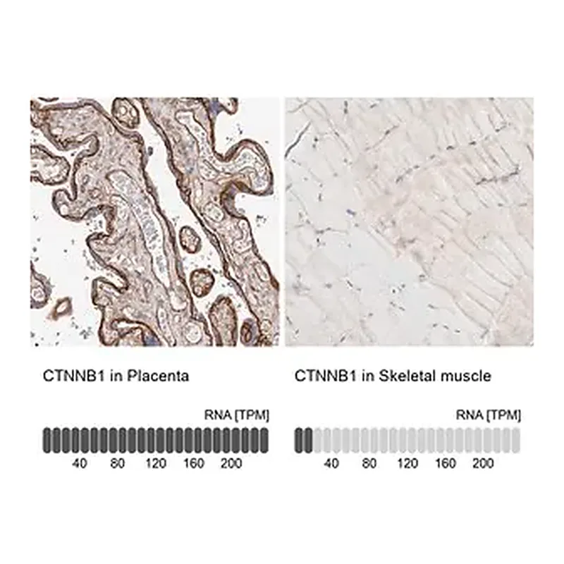 Merck Anti-CTNNB1 antibody produced in rabbit
