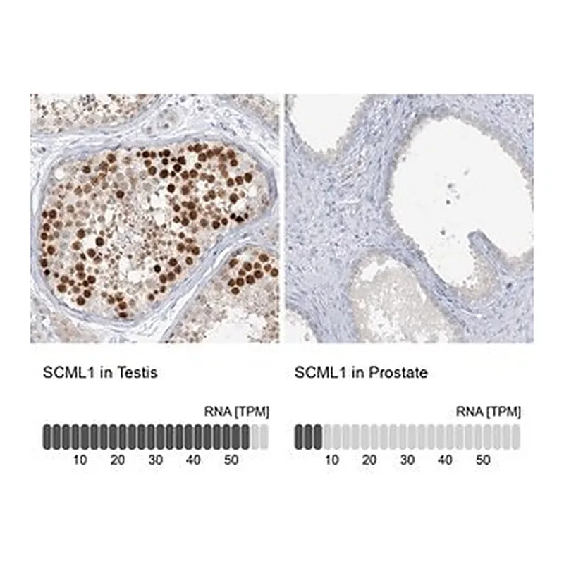 Merck Anti-SCML1 antibody produced in rabbit
