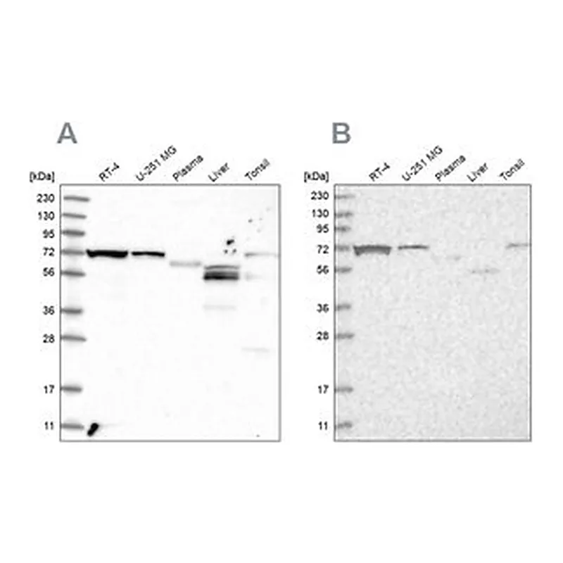 Merck Anti-SLC25A12 antibody produced in rabbit