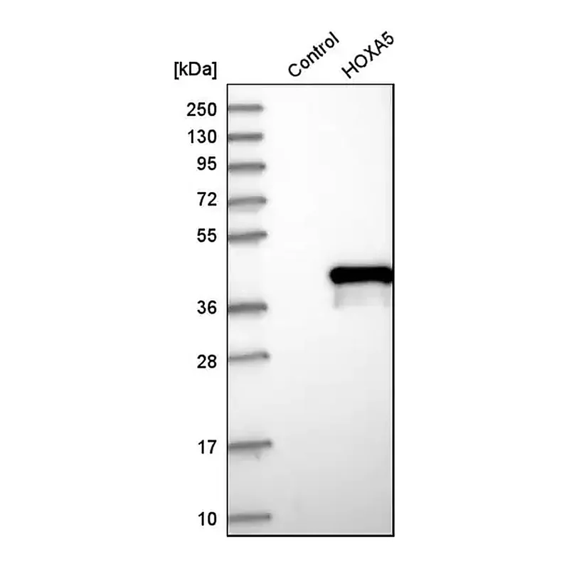 Merck Anti-HOXA5 antibody produced in rabbit