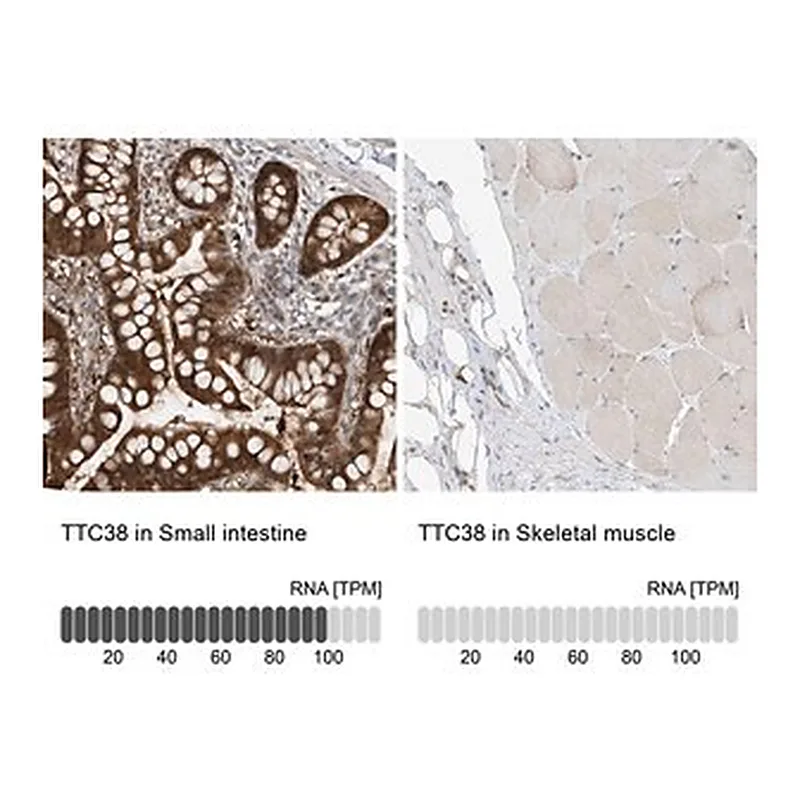 Merck Anti-TTC38 antibody produced in rabbit