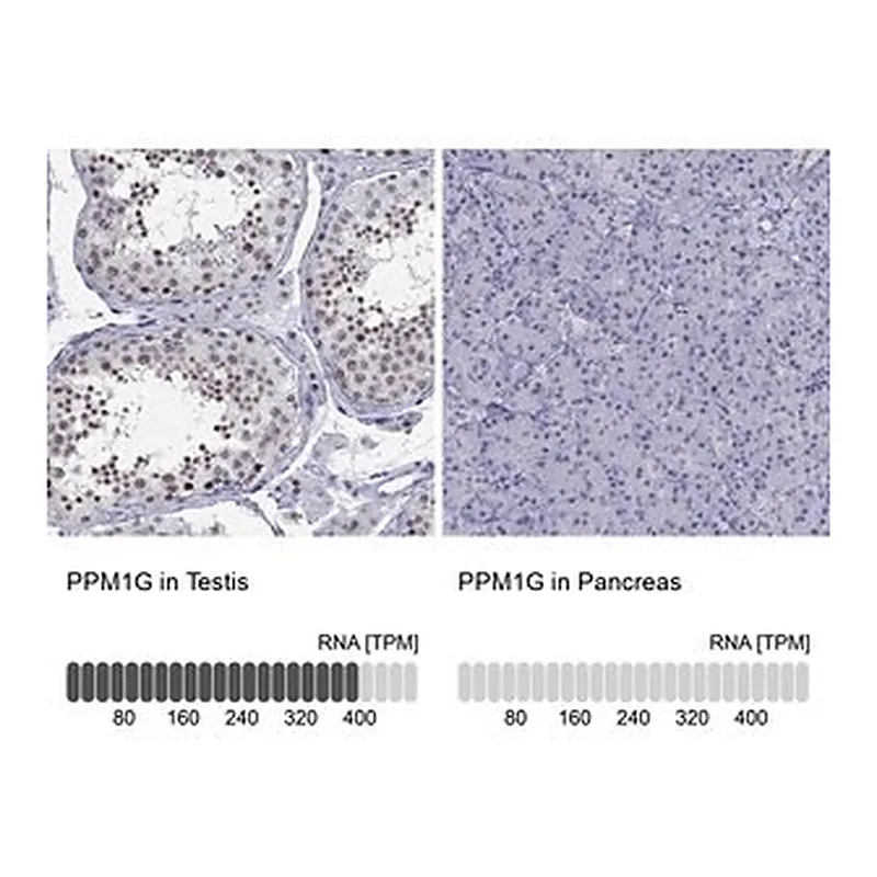 Merck Anti-PPM1G antibody produced in rabbit