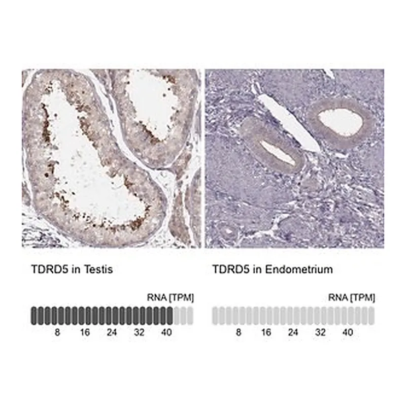 Merck Anti-TDRD5 antibody produced in rabbit