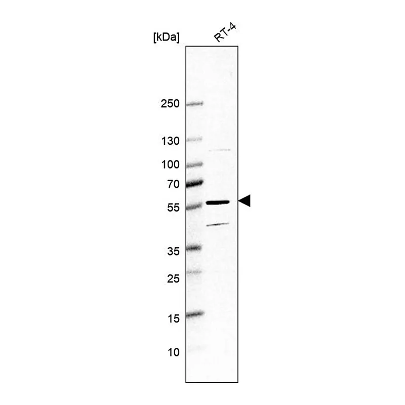 Merck Anti-HYAL4 antibody produced in rabbit