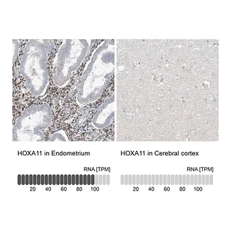Merck Anti-HOXA11 antibody produced in rabbit