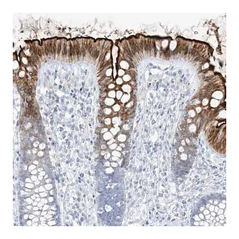 Merck Anti-SLC26A3 antibody produced in rabbit