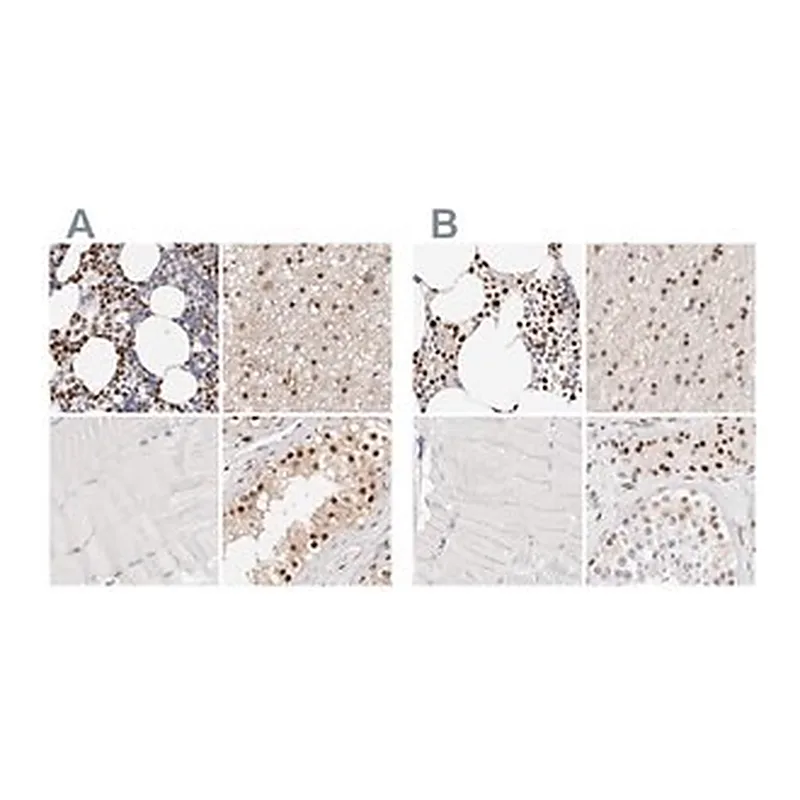 Merck Anti-TKT antibody produced in rabbit