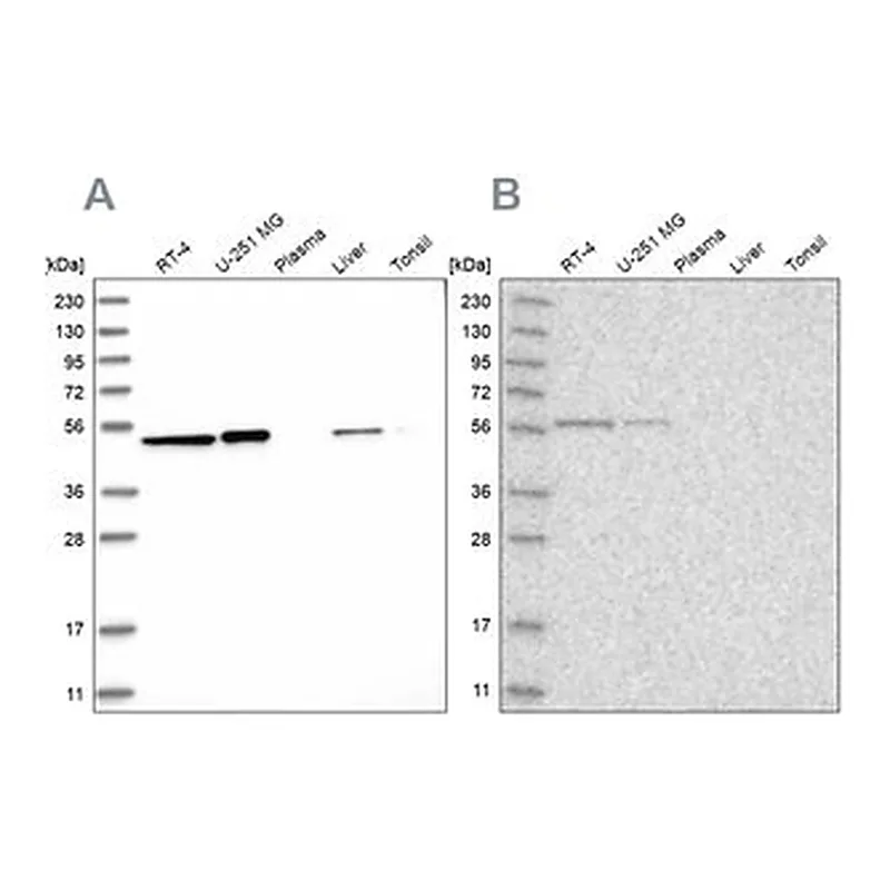 Merck Anti-QRSL1 antibody produced in rabbit