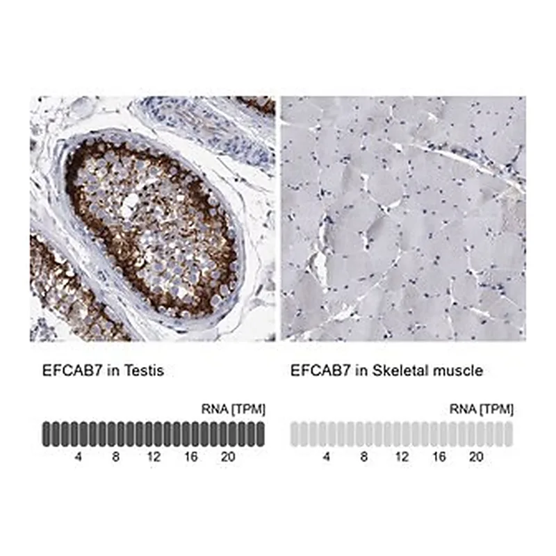 Merck Anti-EFCAB7 antibody produced in rabbit