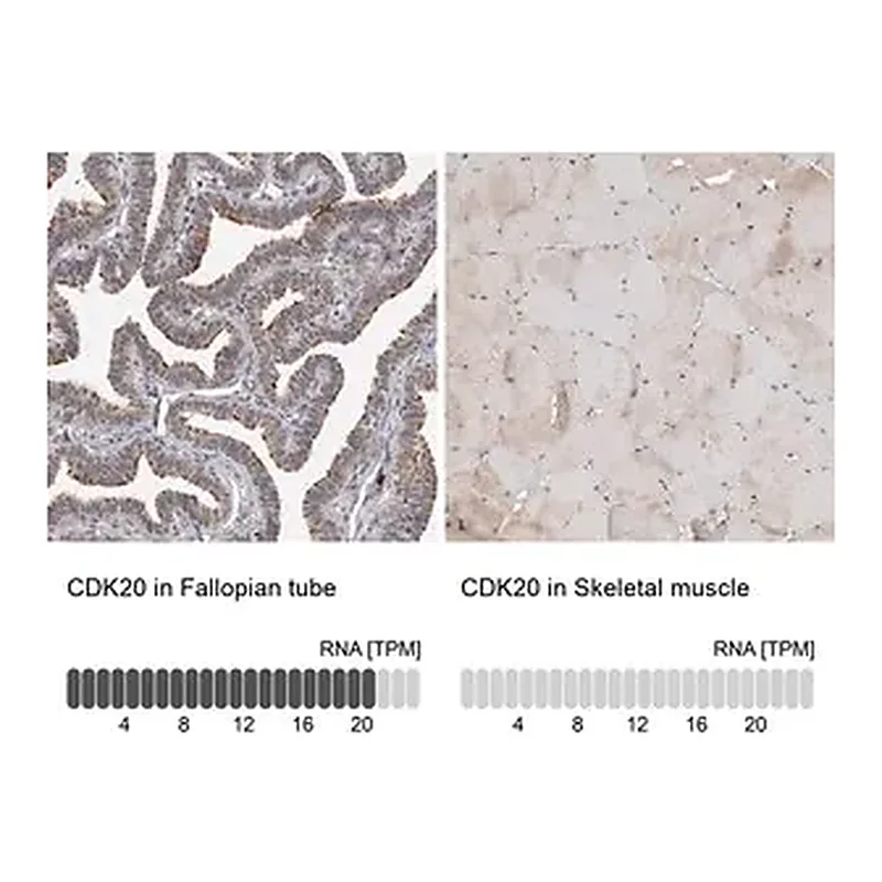 Merck Anti-CDK20 antibody produced in rabbit