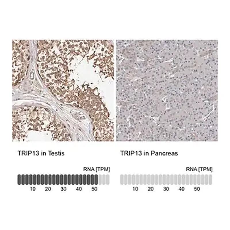Merck Anti-TRIP13 antibody produced in rabbit