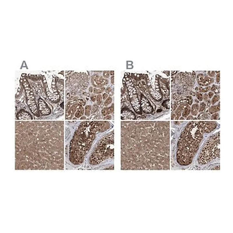 Merck Anti-PSMB1 antibody produced in rabbit
