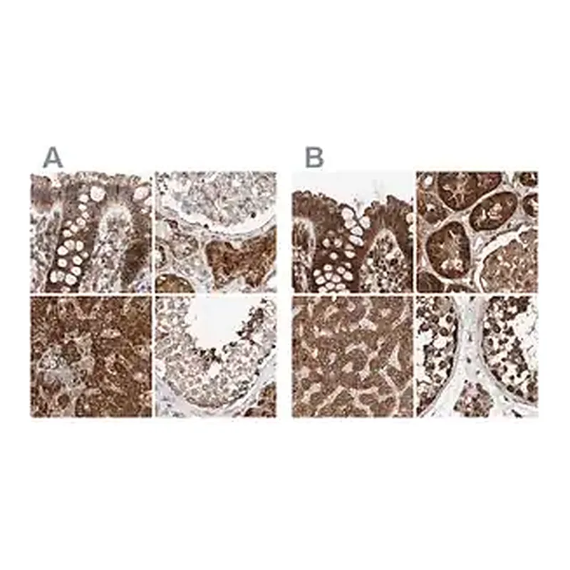 Merck Anti-ZSCAN29 antibody produced in rabbit