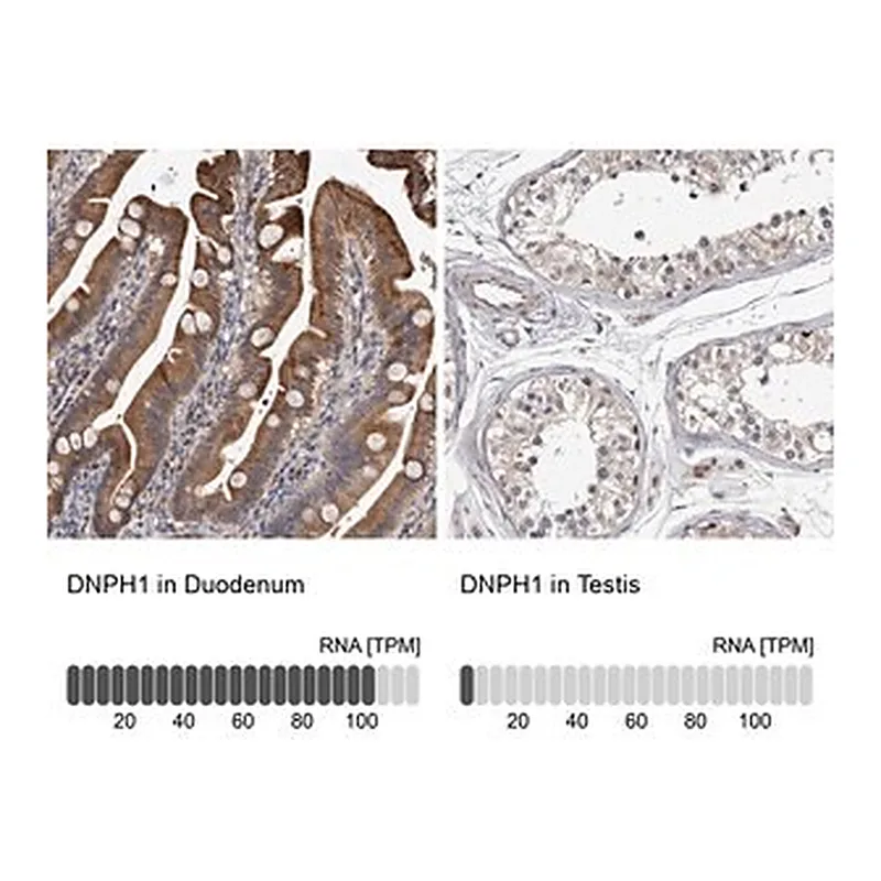 Merck Anti-DNPH1 antibody produced in rabbit