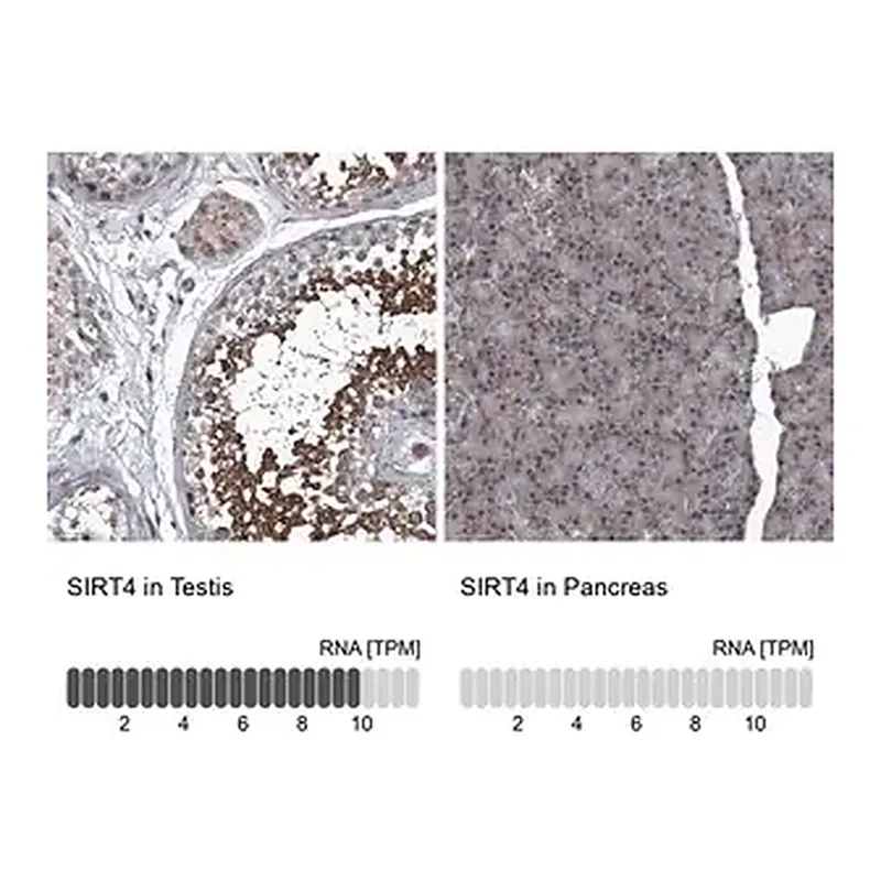 Merck Anti-SIRT4 antibody produced in rabbit