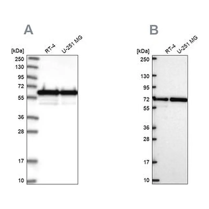 Merck Anti-CCDC47 antibody produced in rabbit