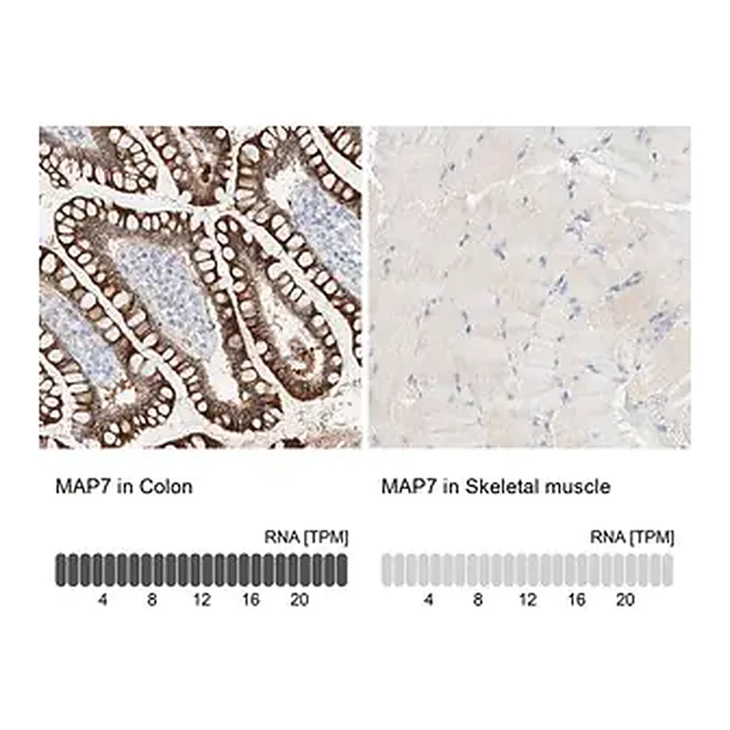 Merck Anti-MAP7 antibody produced in rabbit