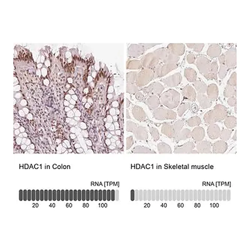 Merck Anti-HDAC1 antibody produced in rabbit