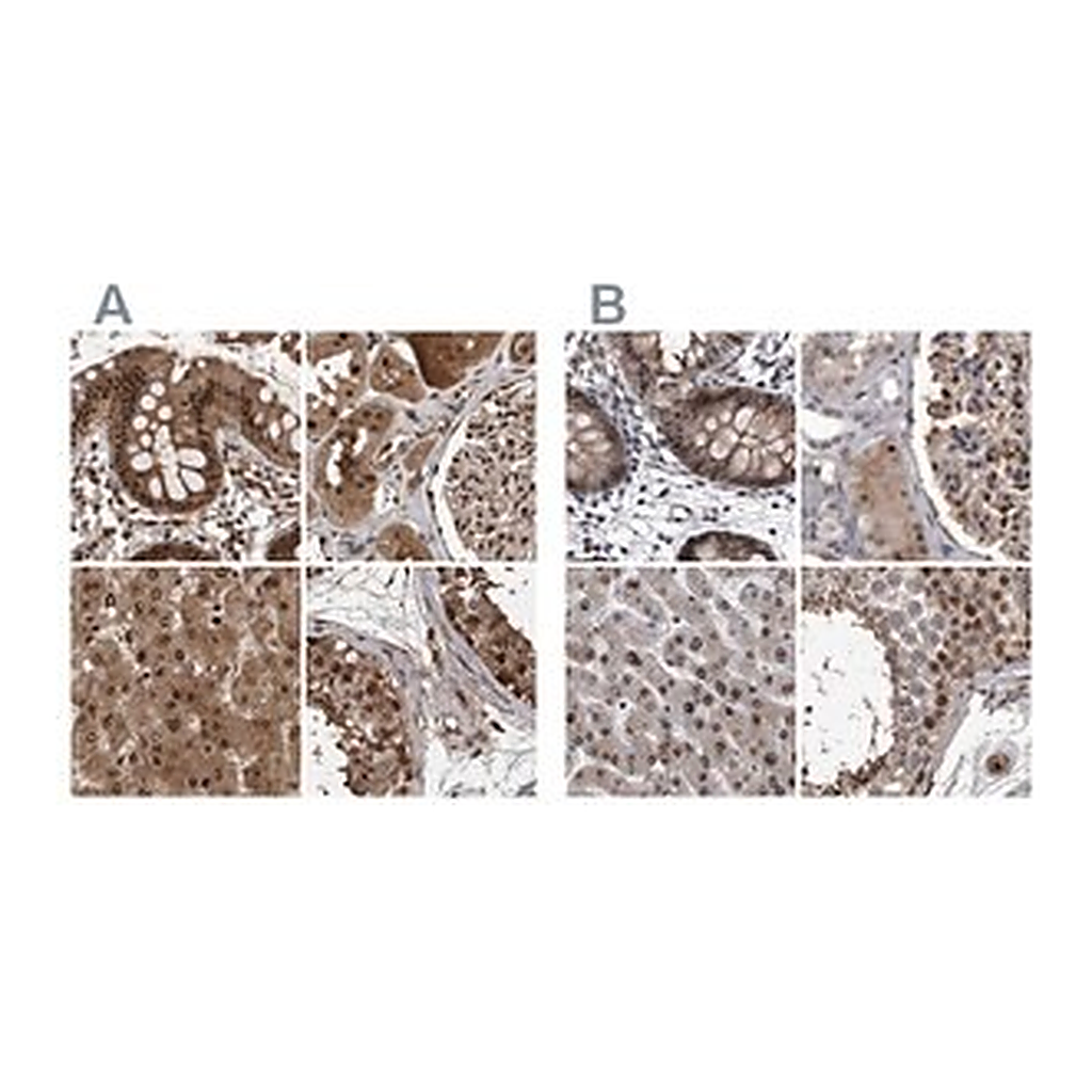 Merck Anti-RAD23B antibody produced in rabbit