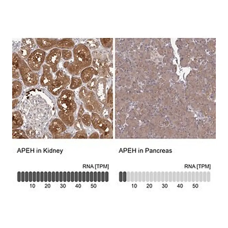 Merck Anti-APEH antibody produced in rabbit