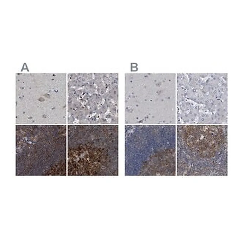 Merck Anti-CDV3 antibody produced in rabbit