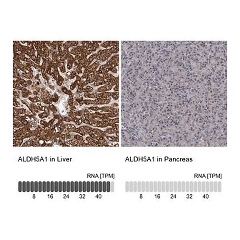 Merck Anti-ALDH5A1 antibody produced in rabbit
