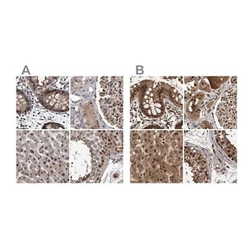 Merck Anti-RAD23B antibody produced in rabbit