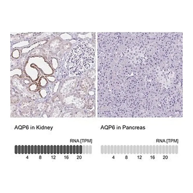 Merck Anti-AQP6 antibody produced in rabbit