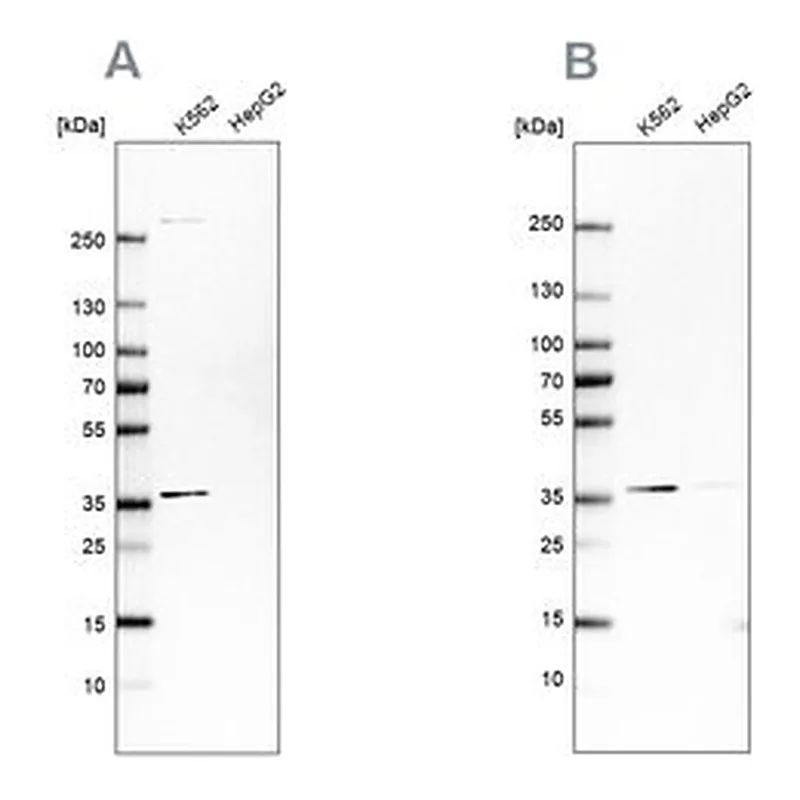 Merck Anti-OTUD6B antibody produced in rabbit