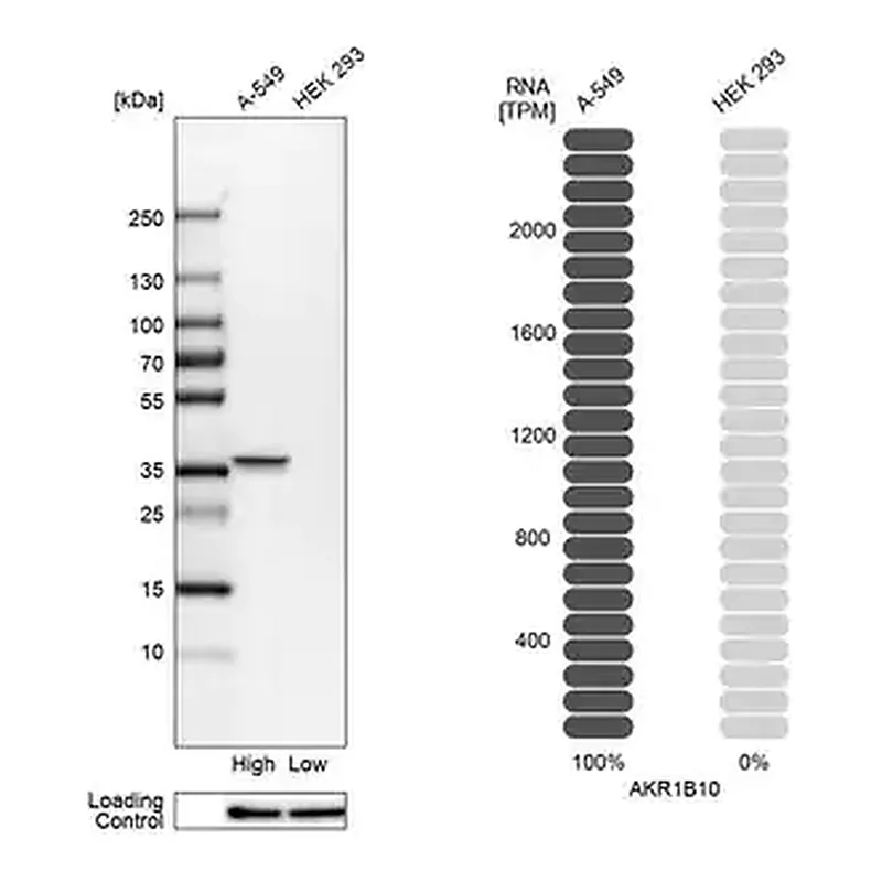 Merck Anti-AKR1B10 antibody produced in rabbit