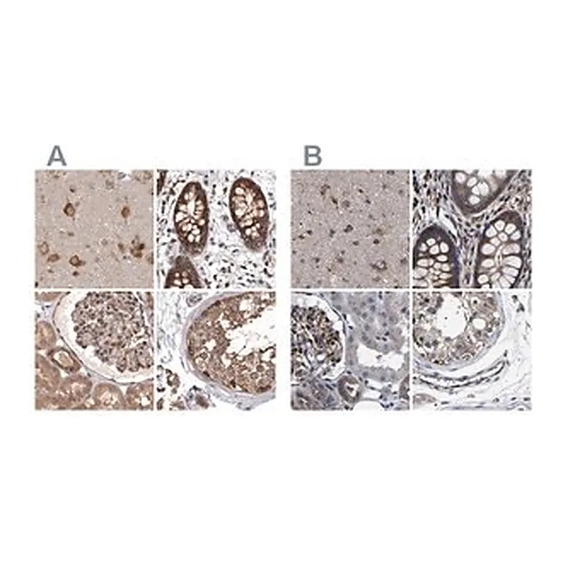 Merck Anti-DARS antibody produced in rabbit