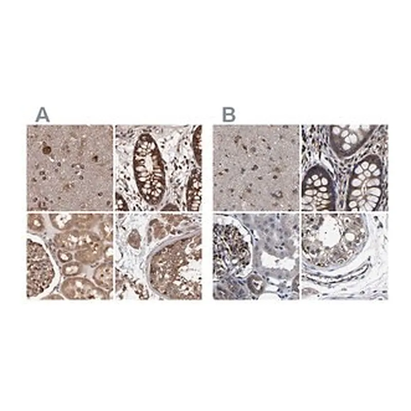 Merck Anti-DARS antibody produced in rabbit