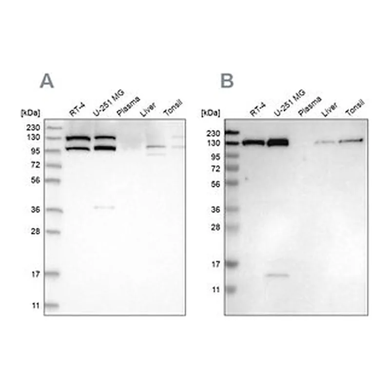 Merck Anti-XPO5 antibody produced in rabbit