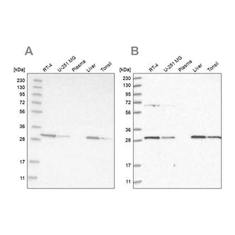 Merck Anti-PROSC antibody produced in rabbit