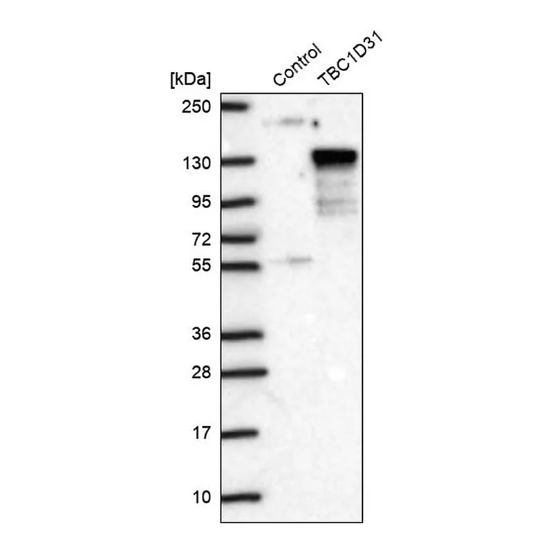 Merck Anti-TBC1D31 antibody produced in rabbit