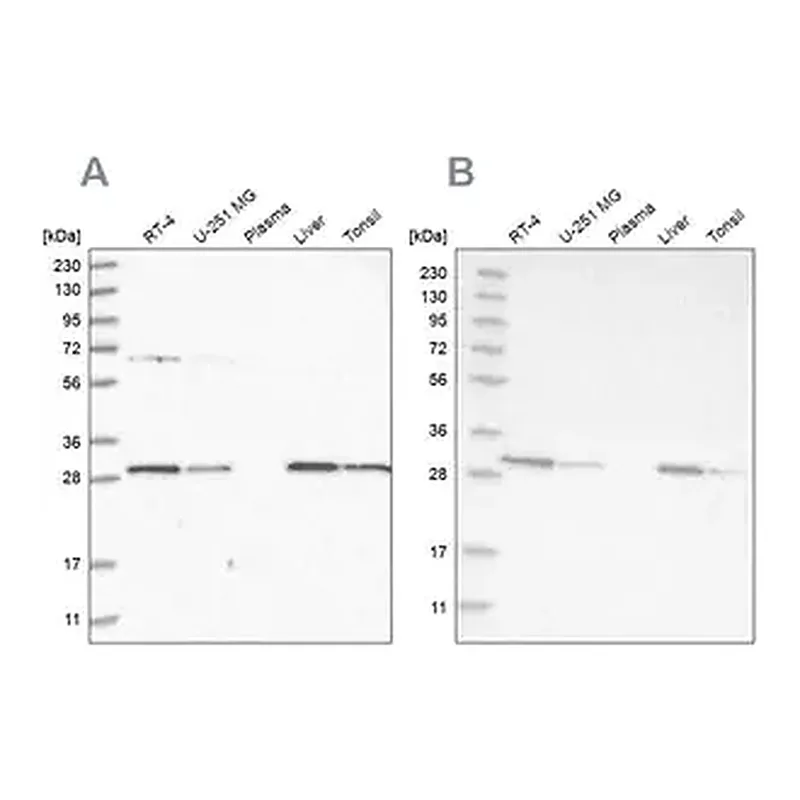 Merck Anti-PROSC antibody produced in rabbit