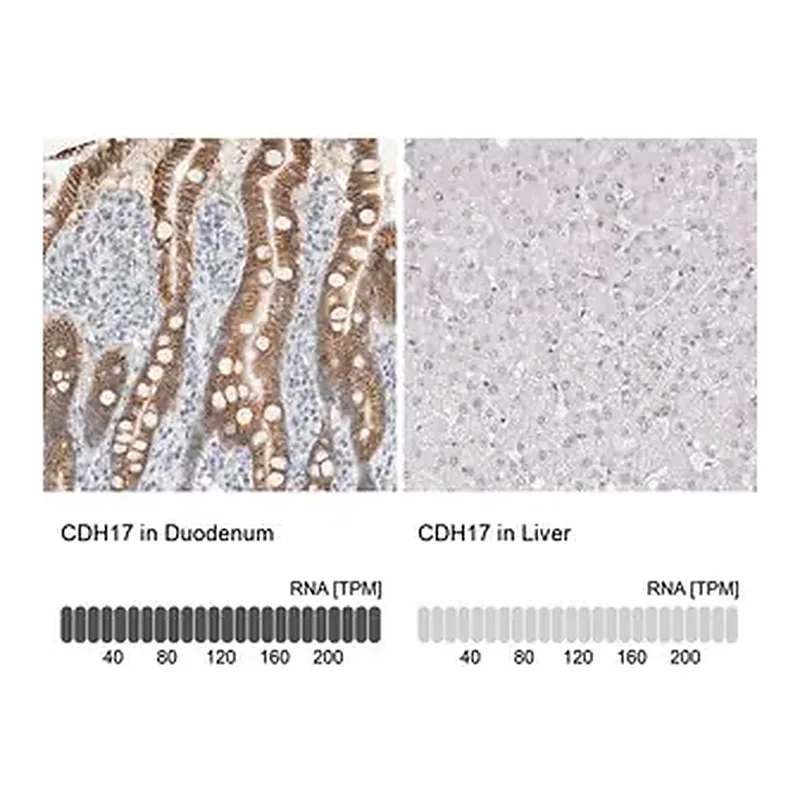 Merck Anti-CDH17 antibody produced in rabbit