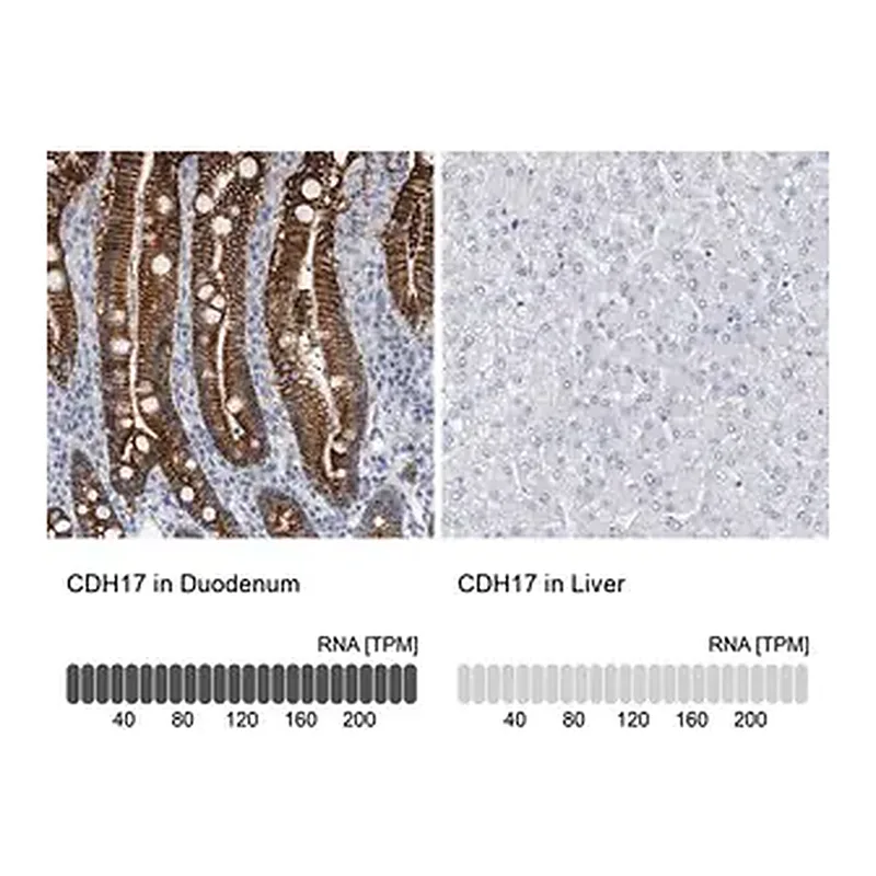 Merck Anti-CDH17 antibody produced in rabbit