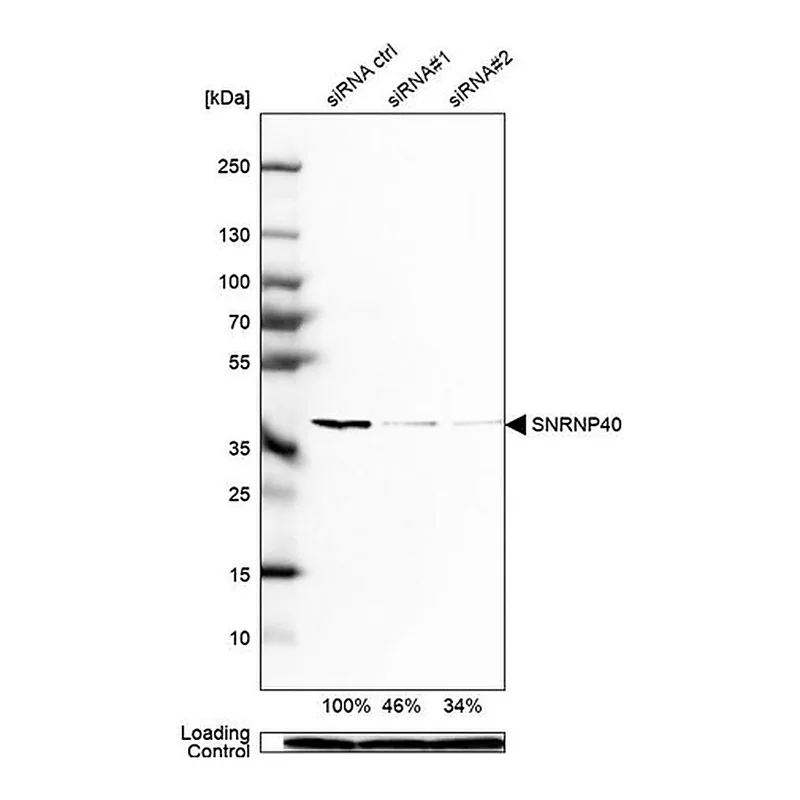 Merck Anti-SNRNP40 antibody produced in rabbit