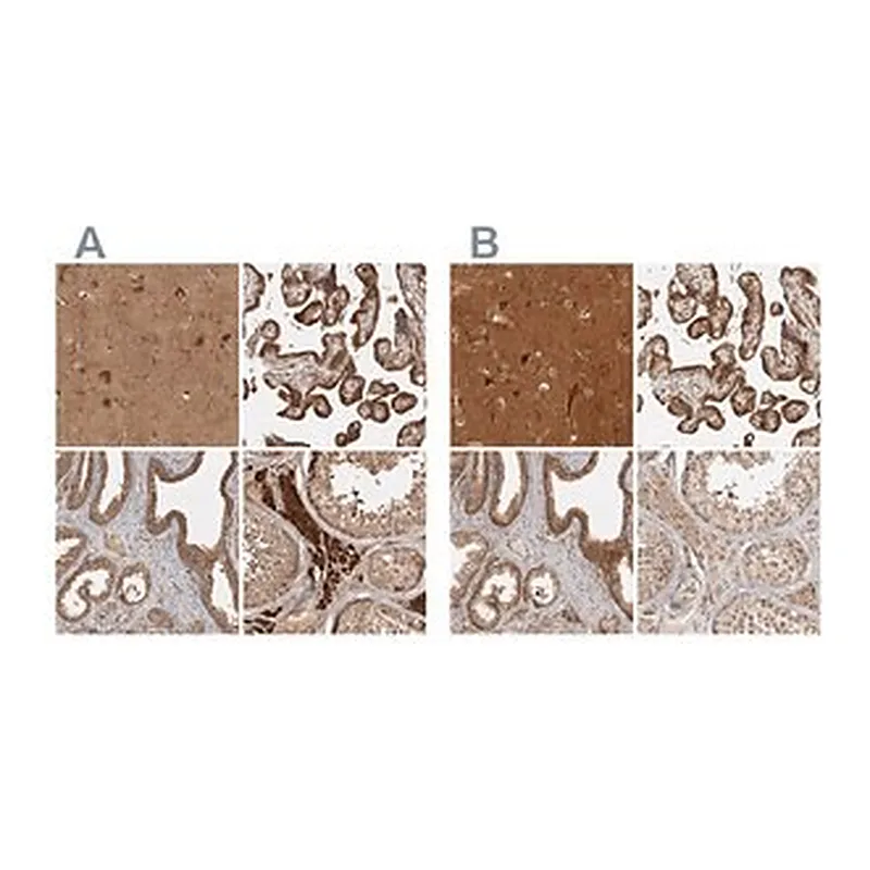 Merck Anti-CAMSAP2 antibody produced in rabbit