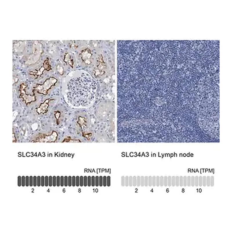 Merck Anti-SLC34A3 antibody produced in rabbit