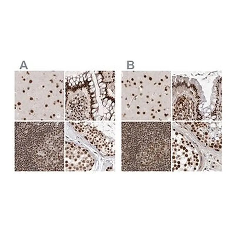 Merck Anti-PPP1R8 antibody produced in rabbit