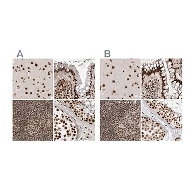 Merck Anti-PPP1R8 antibody produced in rabbit