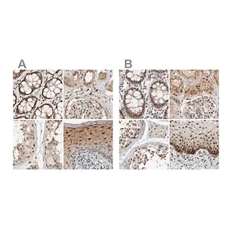 Merck Anti-ZNF521 antibody produced in rabbit