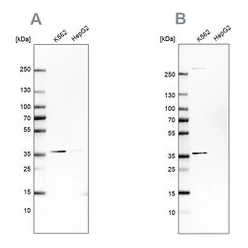 Merck Anti-OTUD6B antibody produced in rabbit