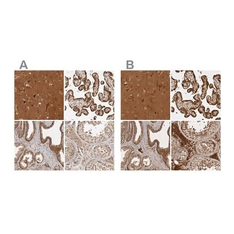 Merck Anti-CAMSAP2 antibody produced in rabbit