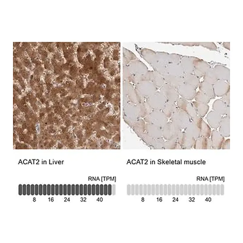 Merck Anti-ACAT2 antibody produced in rabbit